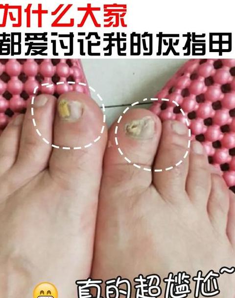 Word文档字体问题及灰色显示解决攻略